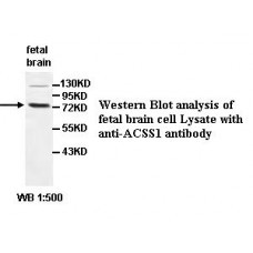 ACSS1 Antibody