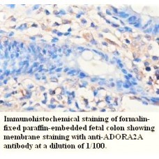  ADORA2A Antibody