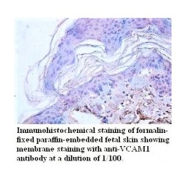  VCAM1Antibody