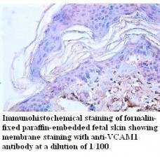  VCAM1Antibody