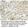 ALDH1L2 Antibody