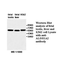  ALDH1A2 Antibody