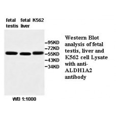  ALDH1A2 Antibody