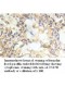ALOX15B Antibody