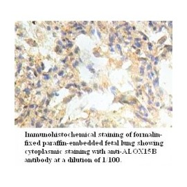  ALOX15B Antibody