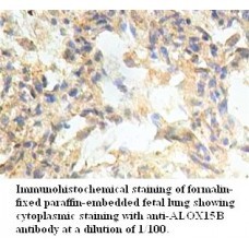  ALOX15B Antibody