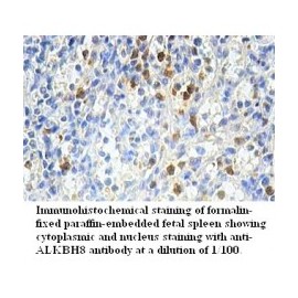  ALKBH8 Antibody