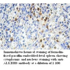  ALKBH8 Antibody