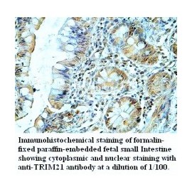  TRIM21 Antibody