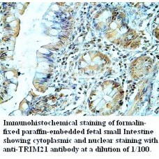  TRIM21 Antibody