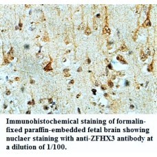  ZFHX3 Antibody