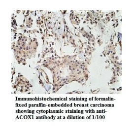 ACOX1 Antibody