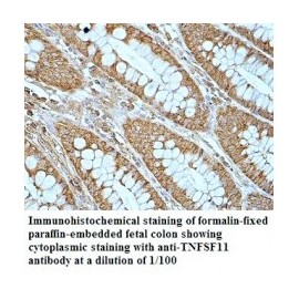  TNFSF11 Antibody