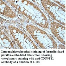  TNFSF11 Antibody