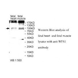  WFS1 Antibody