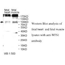  WFS1 Antibody