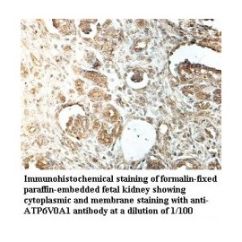  ATP6V0A1 Antibody