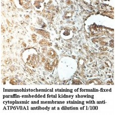  ATP6V0A1 Antibody