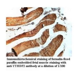 YTHDF2 Antibody
