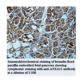  ANXA11 Antibody