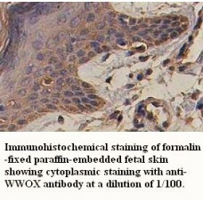  WWOX Antibody