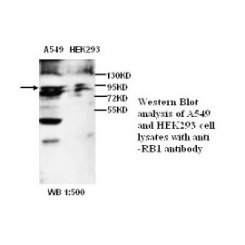  RB1 Antibody