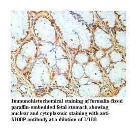  S100P Antibody