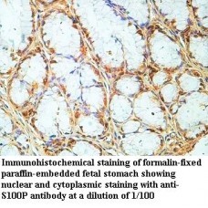  S100P Antibody