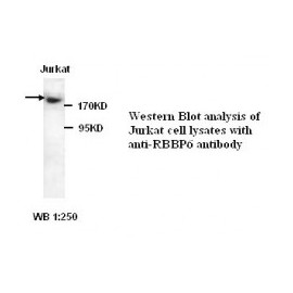  RBBP6 Antibody