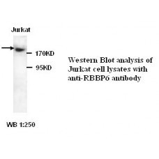  RBBP6 Antibody