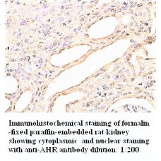  AHR Antibody