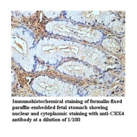  CBX4 Antibody