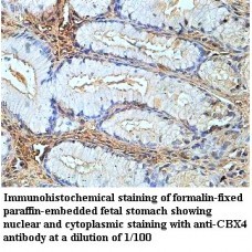  CBX4 Antibody