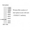 TNFRSF17 Antibody