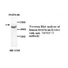  TNFRSF19 Antibody