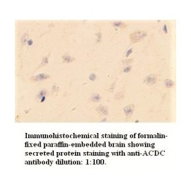 ACDC Antibody