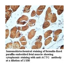  ACTG Antibody
