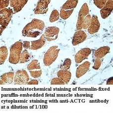  ACTG Antibody