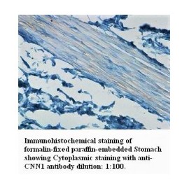  CNN1 Antibody