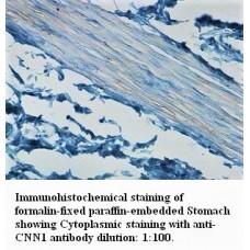  CNN1 Antibody