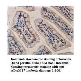  ADAM17 Antibody