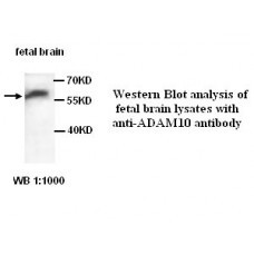  ADAM10 Antibody