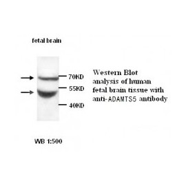 ADAMTS5 Antibody