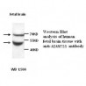 ADAMTS5 Antibody
