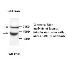 ADAMTS5 Antibody