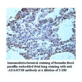 ADAMTS8 Antibody