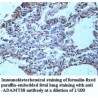 ADAMTS8 Antibody