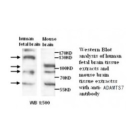 ADAMTS7 Antibody