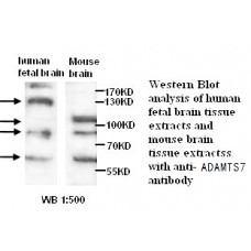 ADAMTS7 Antibody