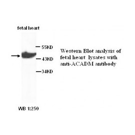 ACADM Antibody
